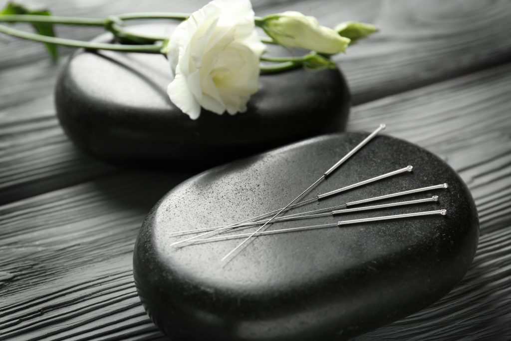acupuncture AHM